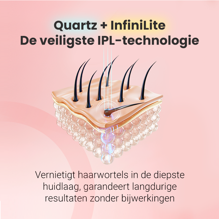 Epilateur à lumière pulsée